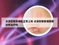 点滴型银屑病能正常上班 点滴型银屑病需要住院治疗吗