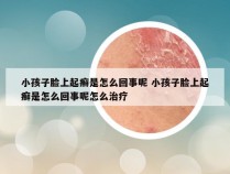 小孩子脸上起癣是怎么回事呢 小孩子脸上起癣是怎么回事呢怎么治疗