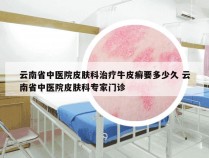 云南省中医院皮肤科治疗牛皮癣要多少久 云南省中医院皮肤科专家门诊