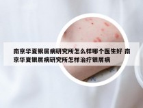 南京华夏银屑病研究所怎么样哪个医生好 南京华夏银屑病研究所怎样治疗银屑病