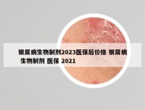 银屑病生物制剂2023医保后价格 银屑病 生物制剂 医保 2021