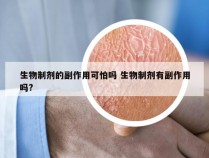 生物制剂的副作用可怕吗 生物制剂有副作用吗?