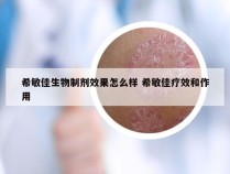 希敏佳生物制剂效果怎么样 希敏佳疗效和作用