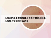 小孩儿的身上有癣摸什么也不下是怎么回事 小孩身上有癣用什么药膏