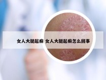 女人大腿起癣 女人大腿起癣怎么回事