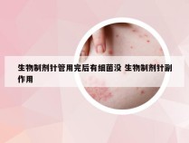 生物制剂针管用完后有细菌没 生物制剂针副作用