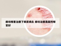 廊坊哪里治腋下银屑病去 廊坊治腋臭医院哪家好