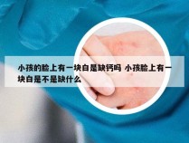 小孩的脸上有一块白是缺钙吗 小孩脸上有一块白是不是缺什么