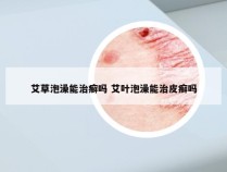 艾草泡澡能治癣吗 艾叶泡澡能治皮癣吗