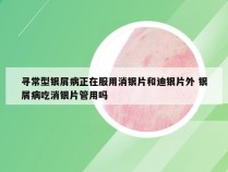 寻常型银屑病正在服用消银片和迪银片外 银屑病吃消银片管用吗