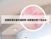 白斑处发红是不是好转 白斑变红斑了怎么办