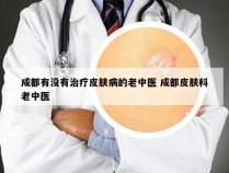 成都有没有治疗皮肤病的老中医 成都皮肤科老中医