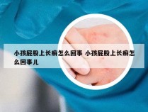 小孩屁股上长癣怎么回事 小孩屁股上长癣怎么回事儿