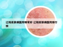 辽阳皮肤病医院哪家好 辽阳皮肤病医院排行榜