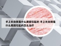 手上长白斑是什么原因引起的 手上长白斑是什么原因引起的怎么治疗