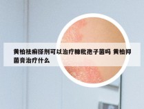 黄柏祛癣搽剂可以治疗糠秕孢子菌吗 黄柏抑菌膏治疗什么