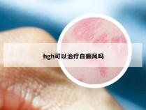 hgh可以治疗白癜风吗