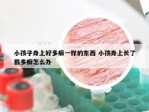 小孩子身上好多癣一样的东西 小孩身上长了很多癣怎么办