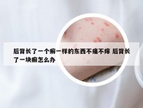 后背长了一个癣一样的东西不痛不痒 后背长了一块癣怎么办