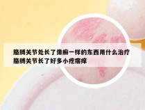 胳膊关节处长了像癣一样的东西用什么治疗 胳膊关节长了好多小疙瘩痒