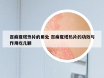 百癣夏塔热片的用处 百癣夏塔热片的功效与作用吃几颗