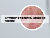 治疗皮肤病的生物制剂安全吗 治疗皮肤病生物制剂是啥