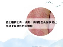 脸上胳膊上白一块黑一块的是怎么回事 脸上胳膊上长黑色的点像痣