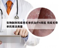 生物制剂司库奇尤单抗治疗4周后 司库尤奇单抗用法用量