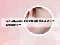 南宁治牛皮癣南宁哪家医院算是最好 南宁皮肤病医院排行