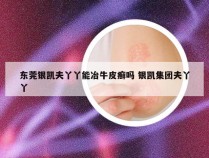 东莞银凯夫丫丫能冶牛皮癣吗 银凯集团夫丫丫