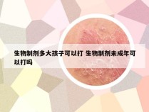 生物制剂多大孩子可以打 生物制剂未成年可以打吗