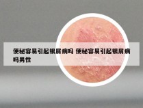 便秘容易引起银屑病吗 便秘容易引起银屑病吗男性