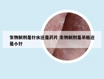 生物制剂是针水还是药片 生物制剂是吊瓶还是小针