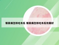 银屑病怎样吃木瓜 银屑病怎样吃木瓜效果好