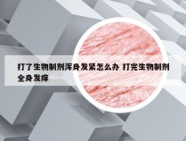 打了生物制剂浑身发紧怎么办 打完生物制剂全身发痒