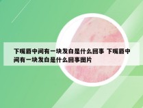 下嘴唇中间有一块发白是什么回事 下嘴唇中间有一块发白是什么回事图片