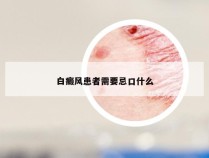 白癜风患者需要忌口什么