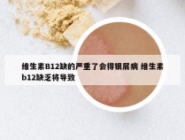 维生素B12缺的严重了会得银屑病 维生素b12缺乏将导致