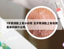 5岁男孩脸上有小白斑 五岁男孩脸上有白斑是体内缺什么吗