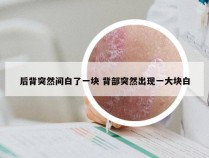 后背突然间白了一块 背部突然出现一大块白