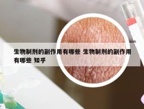 生物制剂的副作用有哪些 生物制剂的副作用有哪些 知乎