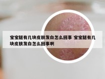 宝宝腿有几块皮肤发白怎么回事 宝宝腿有几块皮肤发白怎么回事啊