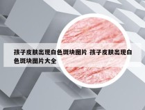 孩子皮肤出现白色斑块图片 孩子皮肤出现白色斑块图片大全