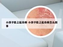 小孩子脸上起白癣 小孩子脸上起白癣怎么回事