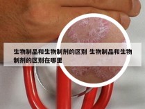 生物制品和生物制剂的区别 生物制品和生物制剂的区别在哪里