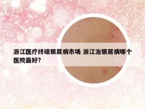 浙江医疗终端银屑病市场 浙江治银屑病哪个医院最好?