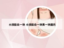 小孩脸白一块 小孩脸白一块黄一块图片