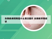 白颠疯病初期是什么情况图片 白颠疯早期症状