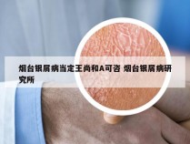 烟台银屑病当定王尚和A可咨 烟台银屑病研究所