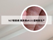 k17银屑病 银屑病ak111是哪里生产